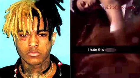 xxx tentacion autopsy|Autopsyfiles.org 